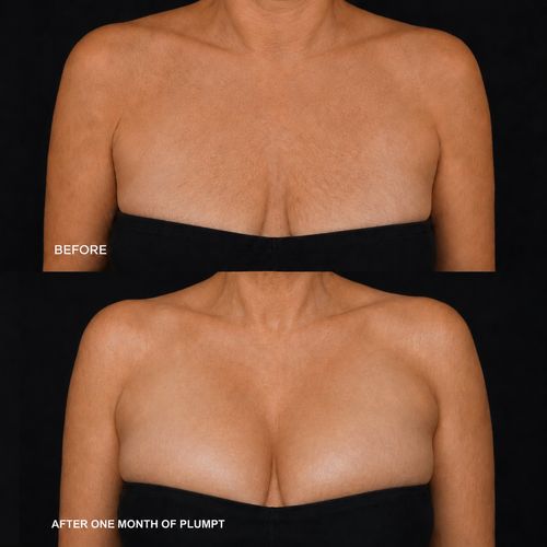 PLUMPT Breast Patches